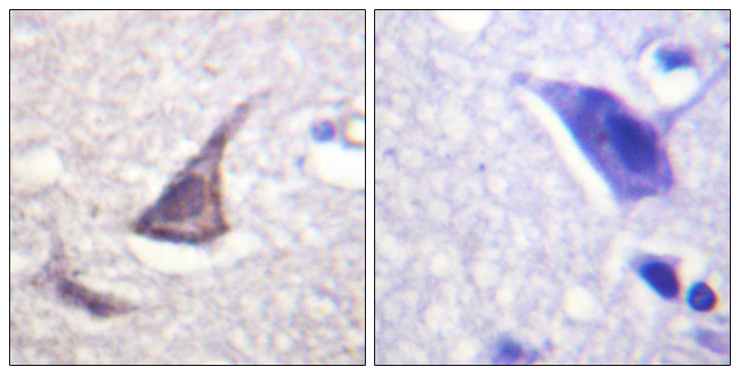 Polyclonal Rabbit anti-Human C/EBP Epsilon / CEBPE Antibody (aa40-89, IHC, IF, WB)