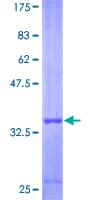 Human MIP2 / GRO2 / CXCL2 Protein (Recombinant GST)