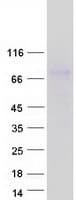 Human LRRC32 Protein (Recombinant Myc-DDK (Flag))