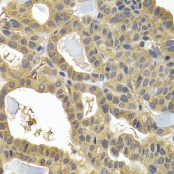 Polyclonal Rabbit anti-Human HSPB8 / H11 / HSP22 Antibody (IHC, IF, WB)