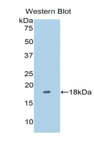 TRIP / LRRFIP1 Antibody (aa128-250)