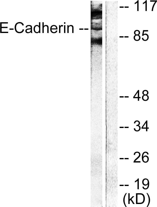 Cadherin Antibody (aa833-882)
