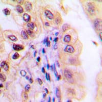 USP32 Antibody (Internal)