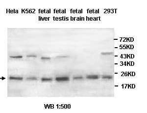 PARK7 / DJ-1 Antibody