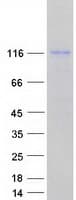 Human DHX34 Protein (Recombinant Myc-DDK (Flag))