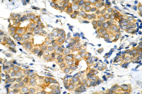 GSK3A / GSK3 Alpha Antibody (Gly15)
