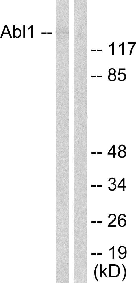 ABL1 / c-ABL Antibody (p204)