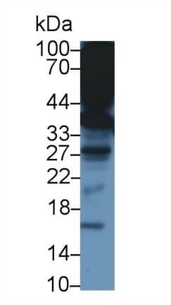 TTPA Antibody (aa88-253)