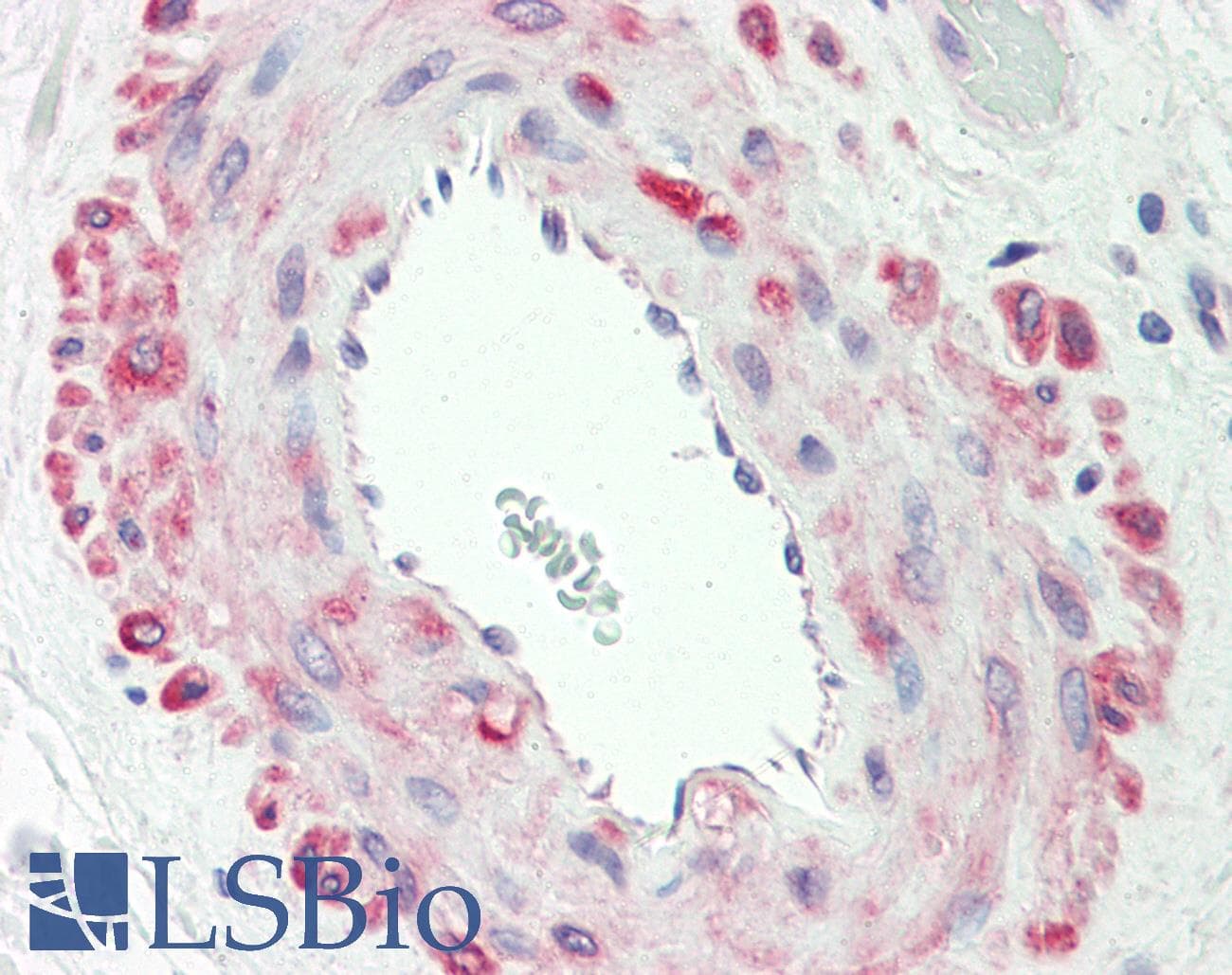 IHC-plus™ Polyclonal Rabbit anti-Human CSNK1G1 / CKI-Gamma 1 Antibody (aa1-50, IHC, WB)
