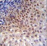CCDC36 Antibody (aa422-450)