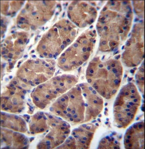 PFDN5 / MM1 Antibody (aa79-108)