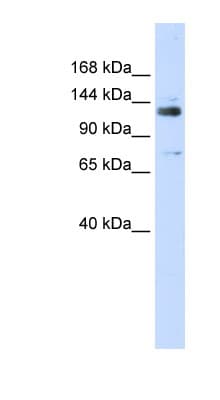 Polyclonal Rabbit anti-Human GTF2I / TFII I Antibody (C-Terminus, WB)