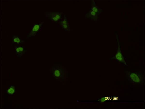 Monoclonal Mouse anti-Human PBX1 Antibody (clone 4A2, IHC, IF, WB)
