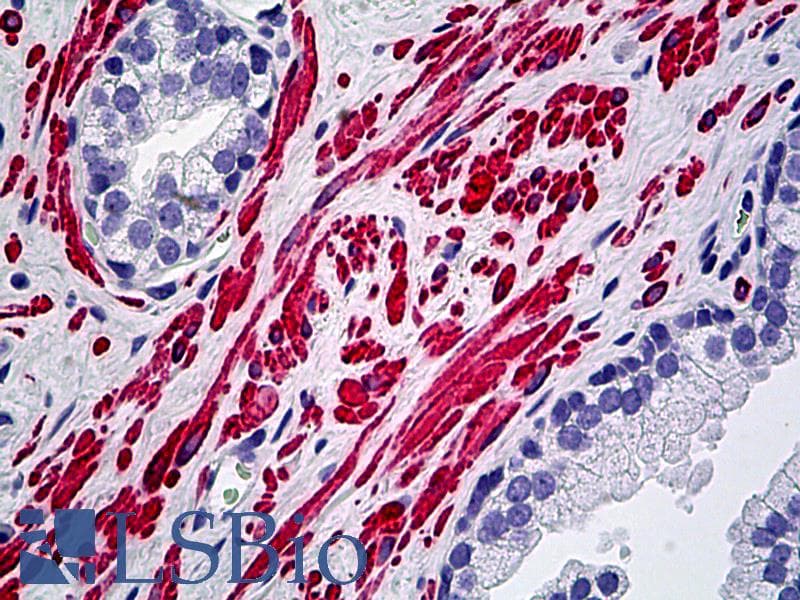 PathPlus™ DES / Desmin Antibody (clone D33, Concentrated)