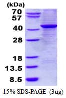 Human GNAZ Protein (Recombinant His)