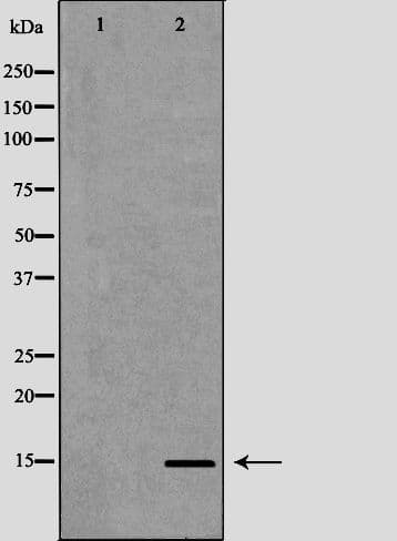 Polyclonal Rabbit anti-Human KCNE1 / MinK Antibody (IHC, IF, WB)