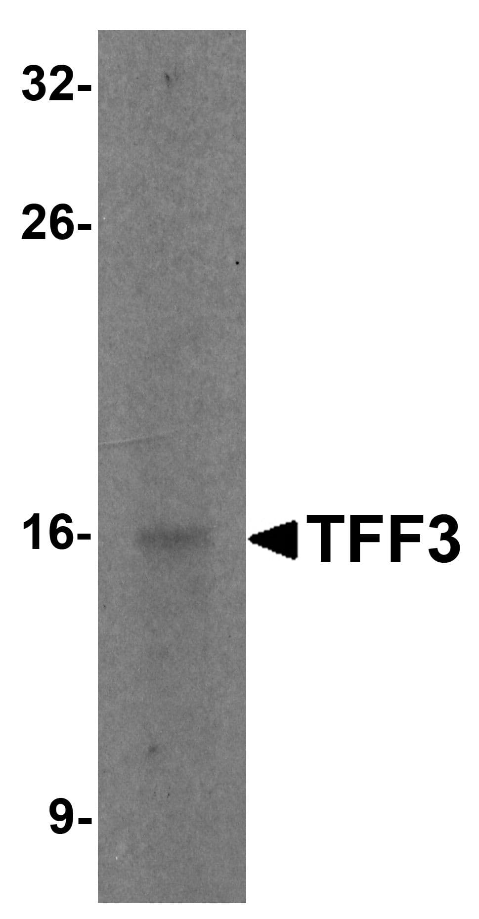 TFF3 / Trefoil Factor 3 Antibody