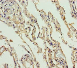 SLC34A1 / NPT2 Antibody