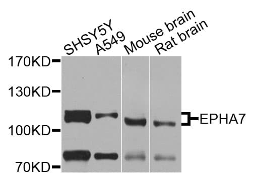 EPHA7 / EPH Receptor A7 Antibody