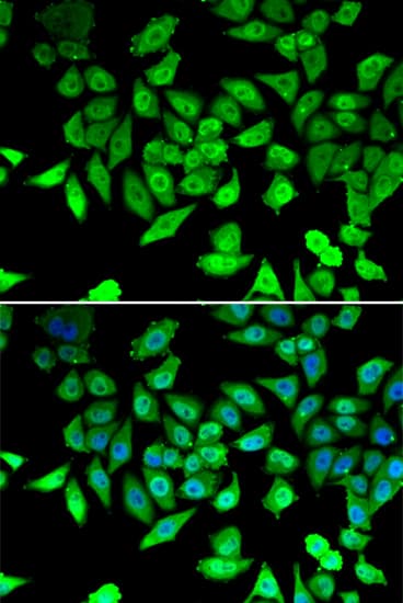 CCAR2 / KIAA1967 Antibody