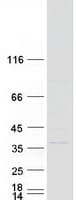 Human M-PST / STM Protein (Recombinant Myc-DDK (Flag))