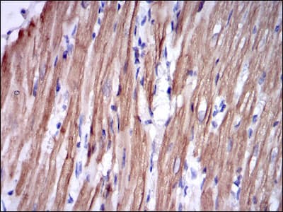 Monoclonal Mouse anti-Human TNNI2 Antibody (clone 2F12A11, IHC, WB)