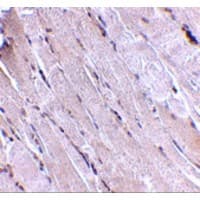Polyclonal Rabbit anti-Human WNT10B Antibody (IHC, WB)