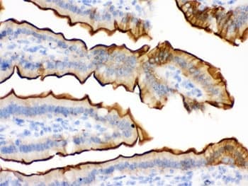 Polyclonal Rabbit anti-Human VIL1 / Villin Antibody (IHC, WB)