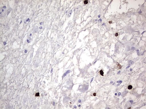 Monoclonal Mouse anti-Human CEACAM5 / CD66e Antibody (clone OTI3D8, aa35-680, IHC, WB)