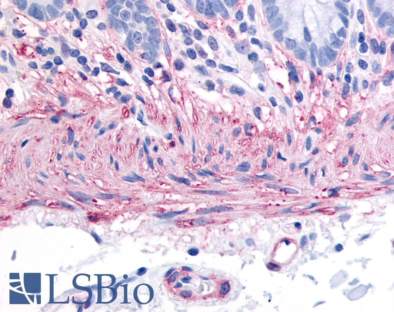 IHC-plus™ TACR2 / NK2R Antibody (C-Terminus)