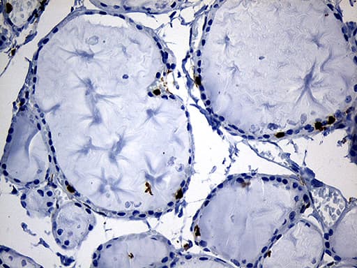 SH3BP1 Antibody (clone OTI1C9)