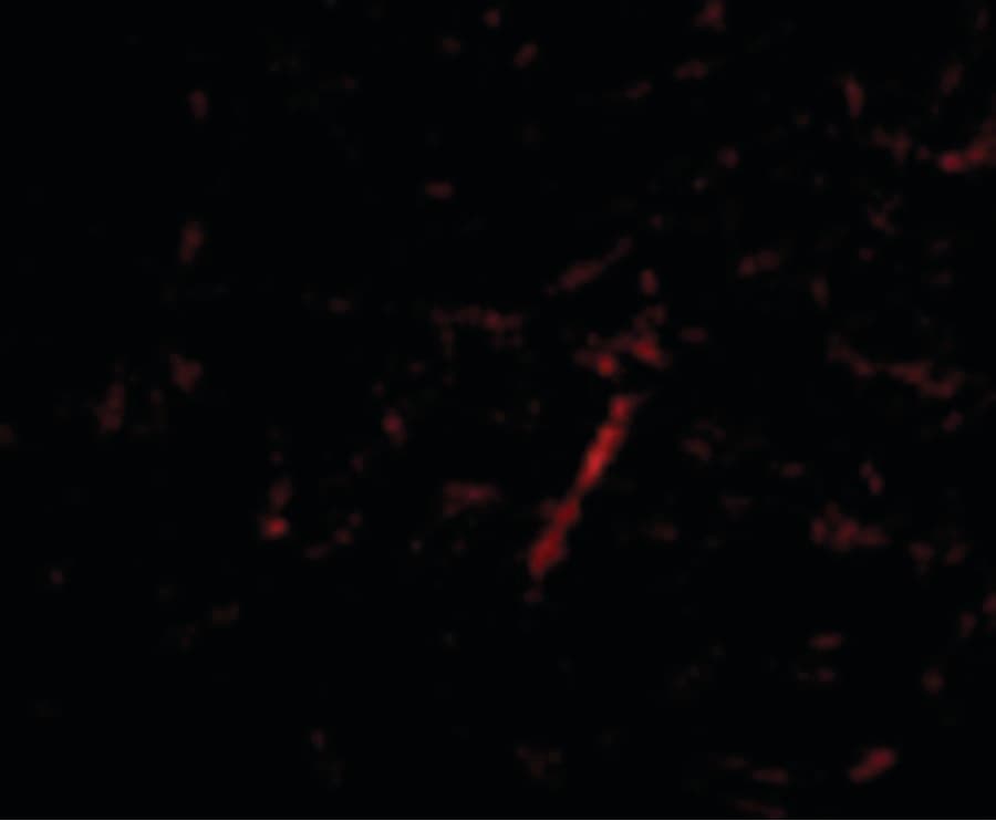 GRIK4 / KA1 Antibody