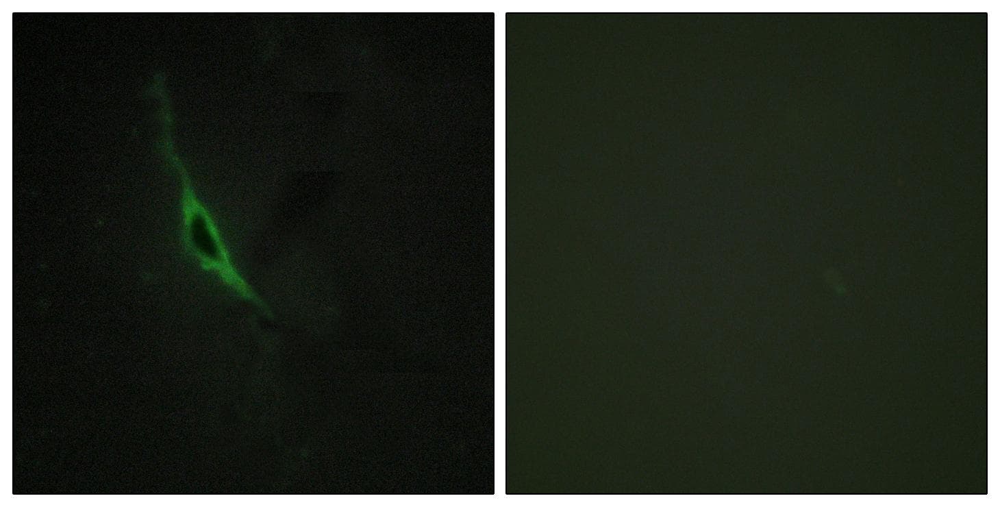 GZMK / Granzyme K Antibody