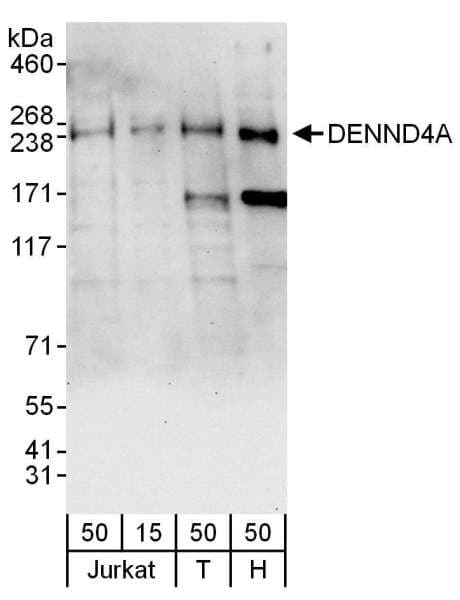 Polyclonal Rabbit anti-Human DENND4A Antibody (aa1525-1575, WB)