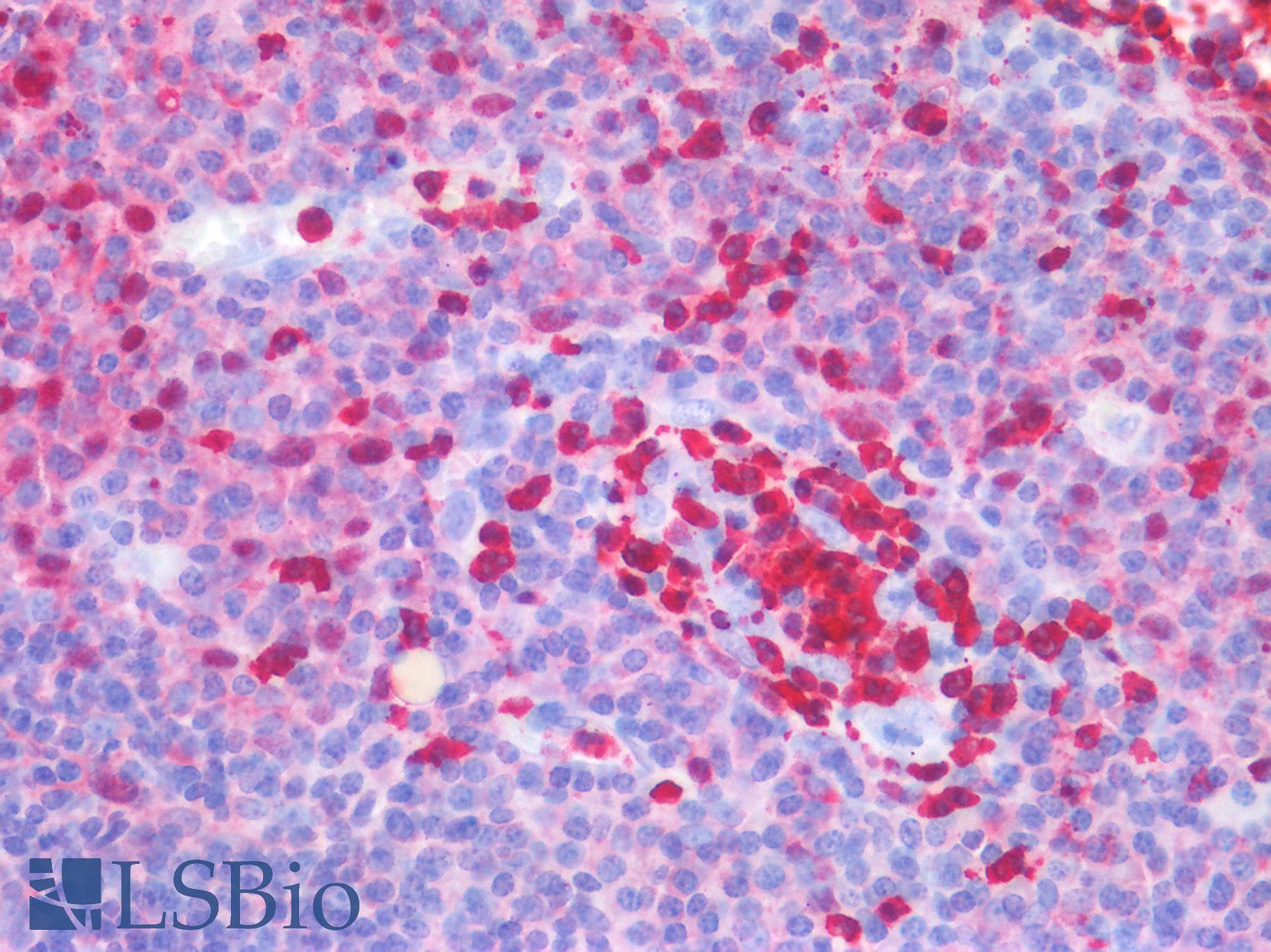 PathPlus™ BTLA / CD272 Antibody