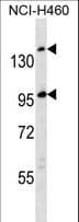 SSC5D Antibody (aa869-897)