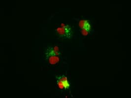 CTNNB1 / Beta Catenin Antibody (clone OTI3G4)