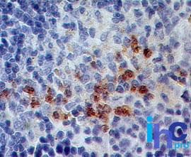 S100A8 / MRP8 Antibody (aa2-80, clone 63N13G5, Azide-free)