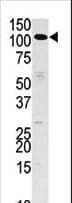 HK3 / Hexokinase 3 Antibody (aa1-30)