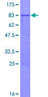 Human RPL3L Protein (Recombinant GST)