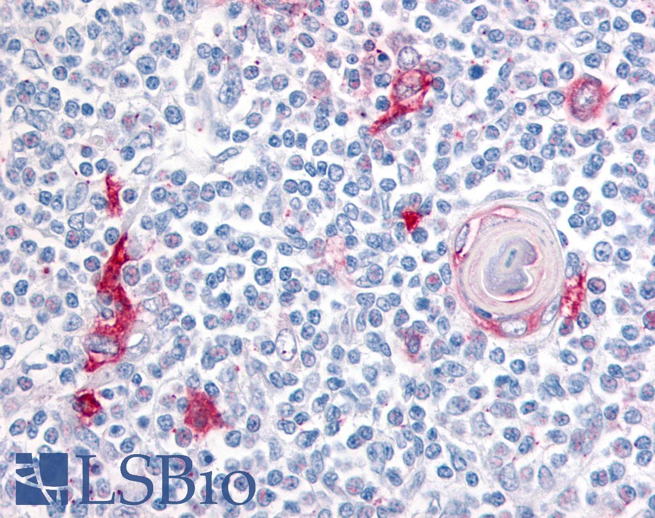 IHC-plus™ Polyclonal Rabbit anti-Human ITGA4 / VLA-4 / CD49d Antibody (C-Terminus, IHC)