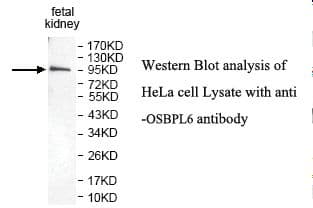 OSBPL6 Antibody (aa14-275)