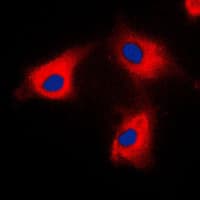 BCKDK Antibody (N-Terminus)