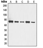 TP63 / p63 Antibody (C-Terminus)