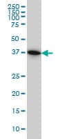 Monoclonal Mouse anti-Human PGGT1B Antibody (clone 5E4, IHC, IF, WB)