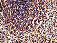 TPD52L2 / HD54 Antibody
