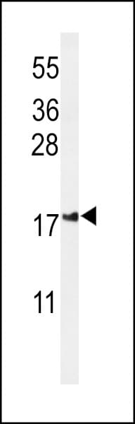 IMMP2L Antibody (aa81-109)