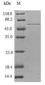 Human TPM4 Protein (Recombinant GST, N-terminus)