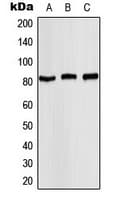 STAT4 Antibody (phospho-Tyr693)