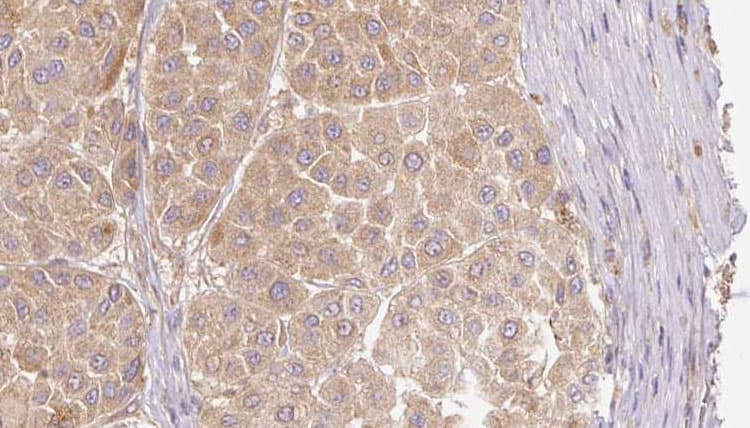 FGF19 Antibody